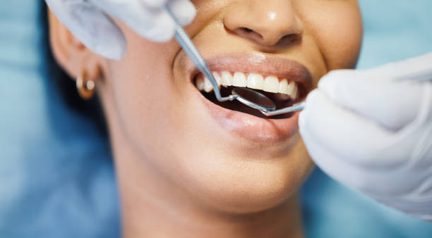 Best Emergency Dental Care for Broken or Chipped Teeth in Manchester, MO